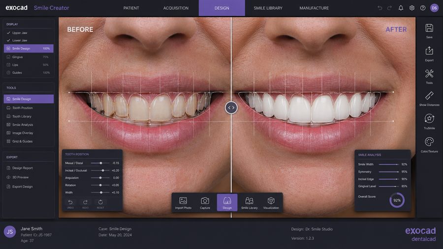 Digital Smile Design (DSD)